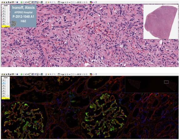 Aperio Digital Pathology Imaging Systems & Workflow Solutions