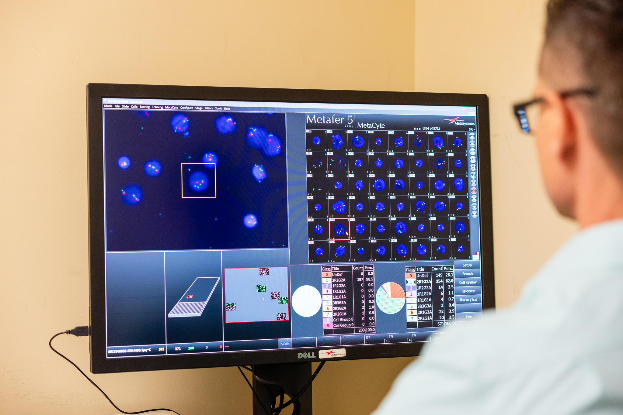 Cytogenetics & FISH